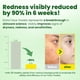 thumbnail image 2 of Toallas faciales desechables Elvira, 100 unidades, biodegradables, 2 of 9