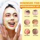 thumbnail image 3 of Mousse limpiadora de cúrcuma A r b c r n, limpiador facial con ácido kójico para lavar la cara y reafirmar la piel, elimina el exceso de queratina y limpia profundamente los poros, 150 ml, 3 of 7