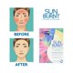 thumbnail image 2 of Mascarilla facial en hoja Sunburnt Ultra Hidratante Recuperación Solar x4, 2 of 5