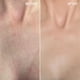 thumbnail image 3 of Suero Spray Cuello Pecho Beauty Pie UBER YOUTH 5 Niacinamida, 3 of 3