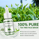 thumbnail image 2 of JoyPretty Acne Face Serum Tea Tree Pimple Removal Oil Control Moisturizing Skin Care Products Facial Serum Beauty Health, 2 of 3