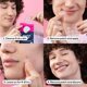 thumbnail image 2 of Parche de Acné HANHOO 108 uds – Reduce espinillas y puntos blancos, 2 of 8