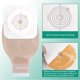 thumbnail image 2 of Bolsa de colostomía SUCONBE de Ostomy Supplies con bolsas drenables, 21 unidades, 2 of 8