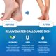 thumbnail image 5 of Set Imperial Feet de Spray Suavizante y Lima para Callos, 5 of 7