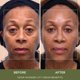 thumbnail image 3 of Crema facial NOOR HAIR Wonder Lift antiedad 30 ml, 3 of 9