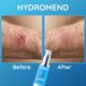 thumbnail image 5 of Gel de Heridas DR. NICE'S 30 ml Reparación de la Piel para Personas Mayores, 5 of 8