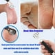 thumbnail image 4 of Rasurador de callos profesional, raspador de pies, la mejor herramienta para el cuidado de los pies y la pedicura., 4 of 5