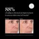 thumbnail image 5 of Serum Naturium Super Serum Plus con vitamina C, 60 ml, 5 of 7