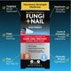 thumbnail image 2 of Pomada antifúngica Fungi-Nail mata hongos, 20 ml con tolnaftato, 2 of 7