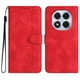 thumbnail image 1 of Funda FOXDOCK para Xiaomi Redmi Note 14 Pro 4G -Diseño elegante,Ideal para hombres y mujeres, 1 of 5