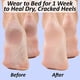 thumbnail image 5 of Calcetines hidratantes The Foot Medic, 6 pares sin dedos, 5 of 6