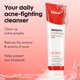 thumbnail image 2 of Limpiador facial HERO COSMETICS 150 ml Ácido salicílico para acné, 2 of 9