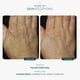 thumbnail image 3 of Crema De Manos Renu 30 Ml Antiedad, 3 of 7