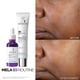 thumbnail image 5 of Serum La Roche-Posay Mela B3 corrector de manchas oscuras 30 ml, 5 of 9