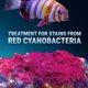 thumbnail image 2 of Tratamiento de Agua Fritz Aquatics – 10 paquetes contra Cianobacterias, 2 of 6