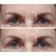 thumbnail image 3 of Aplicador de relleno de cicatrices Dermaflage, 3 of 7
