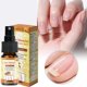 thumbnail image 5 of Spray Calmante para Uñas con Veneno de Abeja Water Ice Levin 2 PCS, 5 of 7