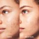 thumbnail image 4 of Suero facial e.l.f. Blemish Breakthrough Mini, 4 of 7