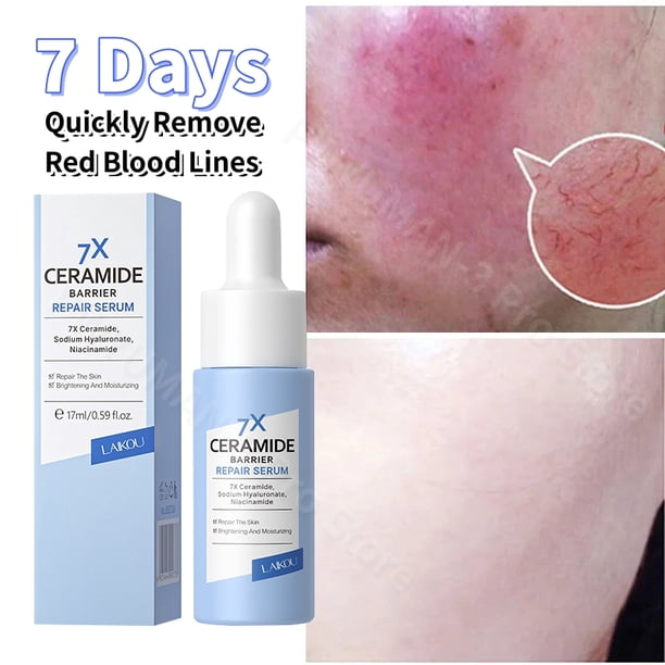 LAIKOU 7X CERAMIDE Facial Serum Rosacea Red Blood Vein Treatment Improve Sensitive Repair Moisturizing Serum Korean Cosmetics