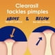 thumbnail image 3 of Limpiador facial Clearasil Control del acné rebelde 5 en 1 200 mL, 3 of 9