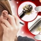 thumbnail image 2 of Ear Wax Removal 360° Spiral Massage Ear Pick Ear Canal Cleaner Stainless Steel Flexible Design Ear Care Tools, 2 of 3