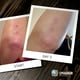thumbnail image 3 of Gel de Baño Sphagnum Botanicals Psoriasis con Turba y Aceite de Oliva, 3 of 3