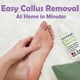 thumbnail image 5 of Eliminador De Callos Extra Strength 240 Ml Para Pies, 5 of 7