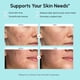 thumbnail image 3 of Crema Facial MAREE con 15% de Ácido Azelaico 30 ml, 3 of 8