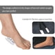 thumbnail image 5 of 6 pares de plantillas de gel para arco de pie plano, almohadilla adhesiva transparente para arco de pie para mujeres y hombres., 5 of 7