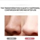 thumbnail image 3 of Deep Clean Your Skin with Ultrasonic Vibration Skin Scrubber - Blackhead Remover, Pore Cleaner, and Comedone Extractor For Women & Men, 3 of 4
