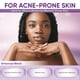 thumbnail image 2 of Crema Aobbiy Ácido Azelaico 30 ml Unisex, 2 of 3