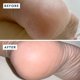 thumbnail image 5 of Bálsamo reparador de talones VOESH Solemate Foot Care Vegan, 5 of 9