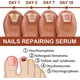 thumbnail image 4 of GFOUK - Sérum para el crecimiento y fortalecimiento de uñas (3 unidades, 7 días), 4 of 7