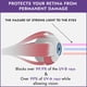 thumbnail image 5 of Gafas de bronceado Super Sunnies Slim Flex sin tirantes UV Eye, 5 of 7