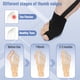 thumbnail image 4 of Corrector de juanetes DR JK para mujeres y hombres, 2 unidades, negro, 4 of 6
