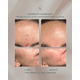 thumbnail image 2 of Kombucha Recovery Serum, 2 of 5