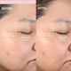 thumbnail image 4 of Dispositivo de limpieza facial PMD Clean con cepillo de silicona resistente al agua, 4 of 9