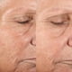 thumbnail image 4 of Kit de microdermoabrasión PMD Beauty Microderm Classic para rostro, 4 of 9