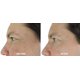 thumbnail image 4 of Sérum Facial DNA Code Argireline Péptidos Ácido Hialurónico 30ml, 4 of 7