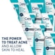 thumbnail image 2 of Limpiador Facial CeraVe Acne 4 Peróxido de Benzoilo 150 ml, 2 of 3