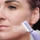 thumbnail image 4 of Sistema de dermaplanamiento Michael Todd Beauty Sonicsmooth Pro+, 4 of 8