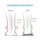 thumbnail image 4 of Plantillas FootScientific Arches Tipo 3 Supinación Arco Alto, 4 of 6