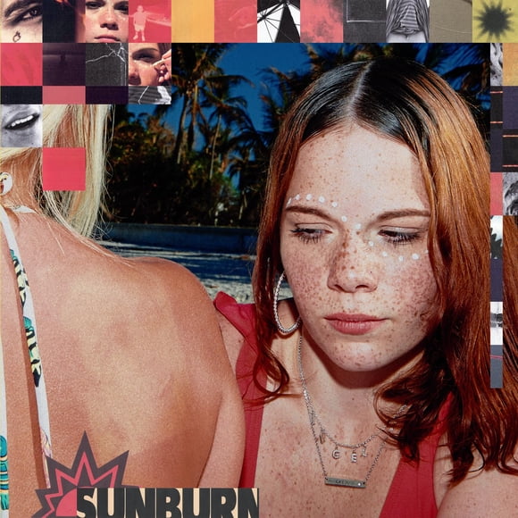 Sunburn COLUMBIA