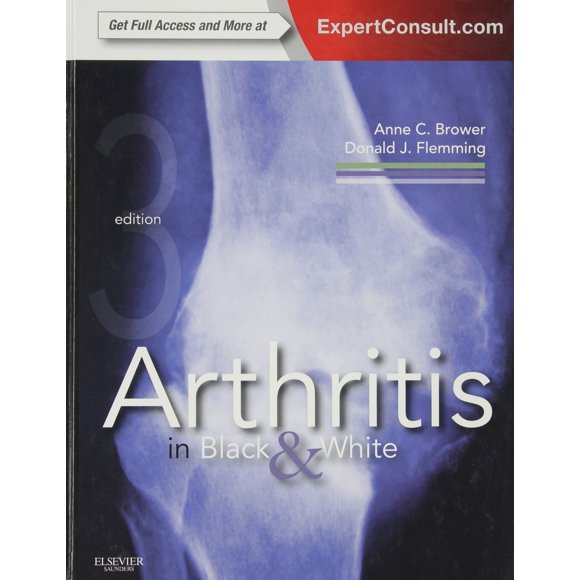 Libro Saunders: Artritis en blanco y negro