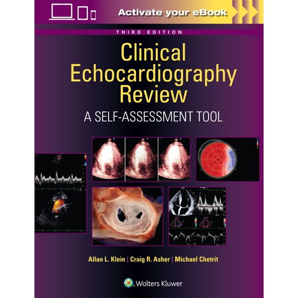 Libro Lippincott Williams & Wilkins de Ecocardiografía