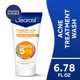 thumbnail image 1 of Limpiador Facial Clearasil Stubborn Acne Exfoliante 200ml, 1 of 3