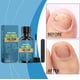 thumbnail image 3 of Gel Antimicótico para el Cuidado de Uñas – 30 ml + Lima, 3 of 3