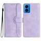 thumbnail image 2 of Funda FOXDOCK para Motorola MOTO G34 5G -Diseño elegante,Ideal para hombres y mujeres, 2 of 5