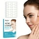thumbnail image 2 of 540 Pcs Acne Covering Sticker: Invisible Makeup Hydrocolloid Patches for Daily & Night Skin Care, Deep Cleansing Pore Stickers, 2 of 4