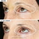 thumbnail image 2 of Sérum para ojos StriVectin Tighten & Lift Peptight 360 Degree, 2 of 8